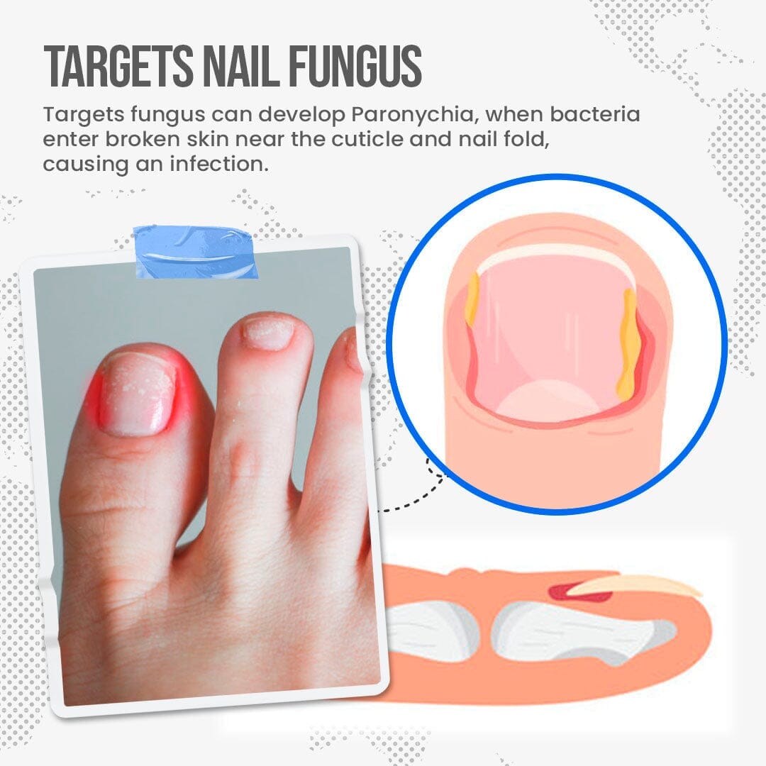 FungusShield Nail Treatment Cream