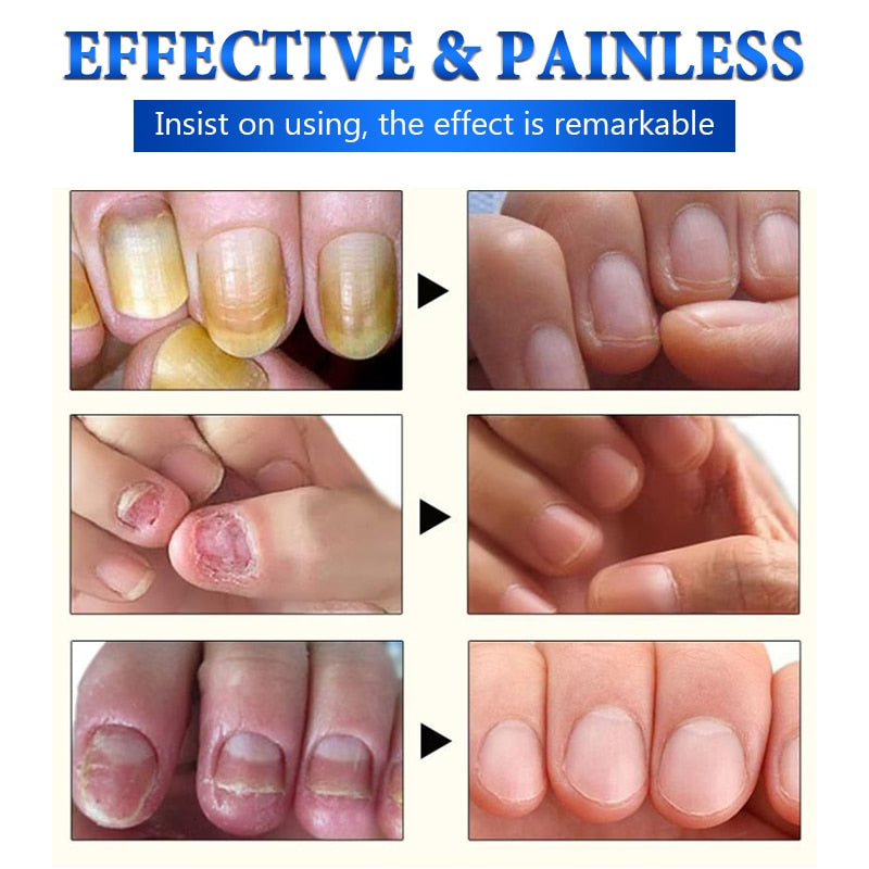 Grey nail repair solution