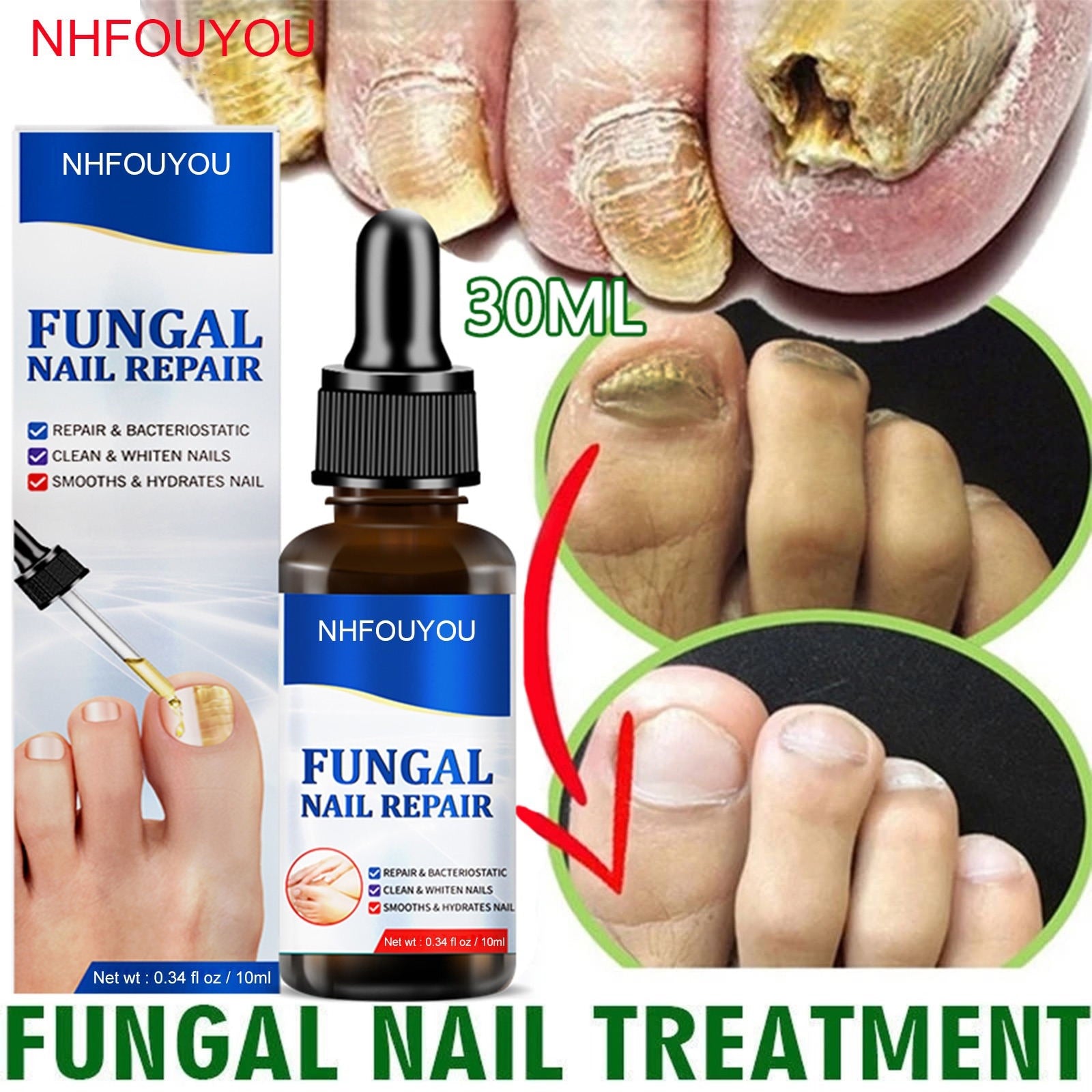 Grey nail repair solution