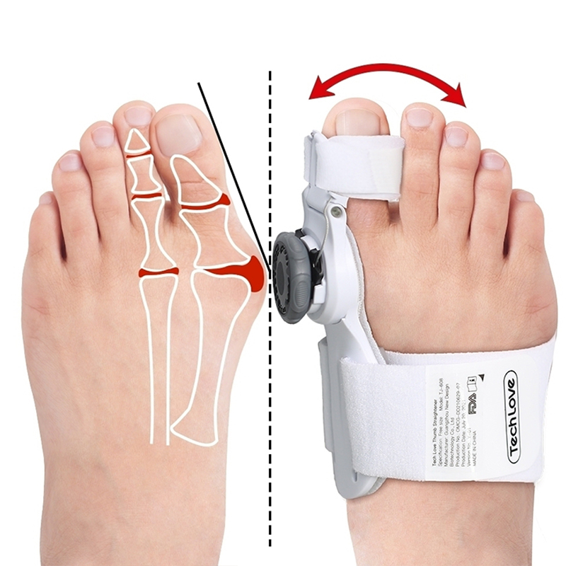 Hallux Valgus Bunion Corrector (LAST DAY 40% SALE OFF)