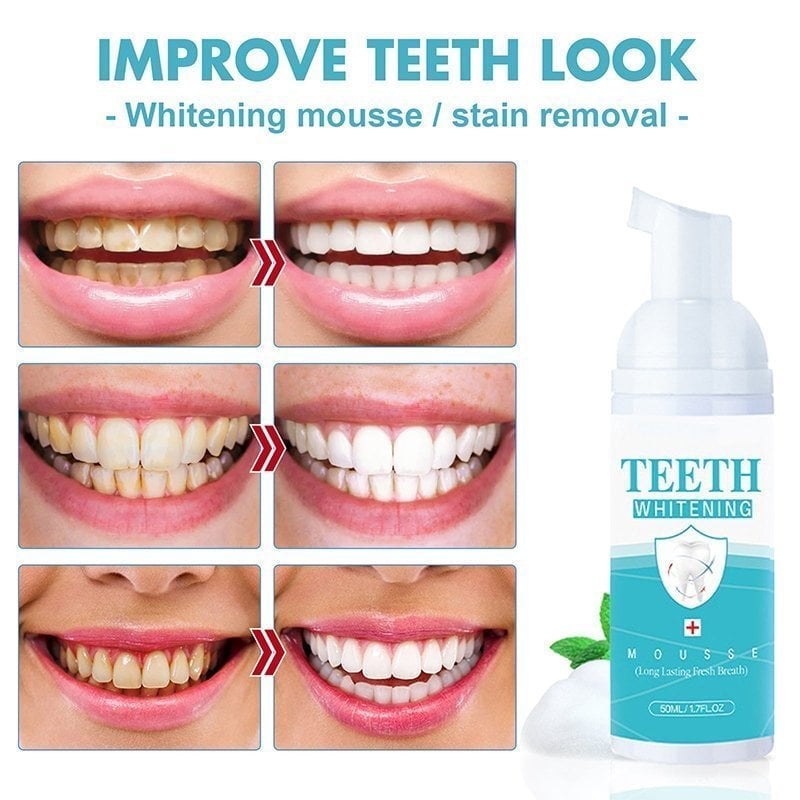 LAST DAY 48% Off – Teeth Whitening Mousse