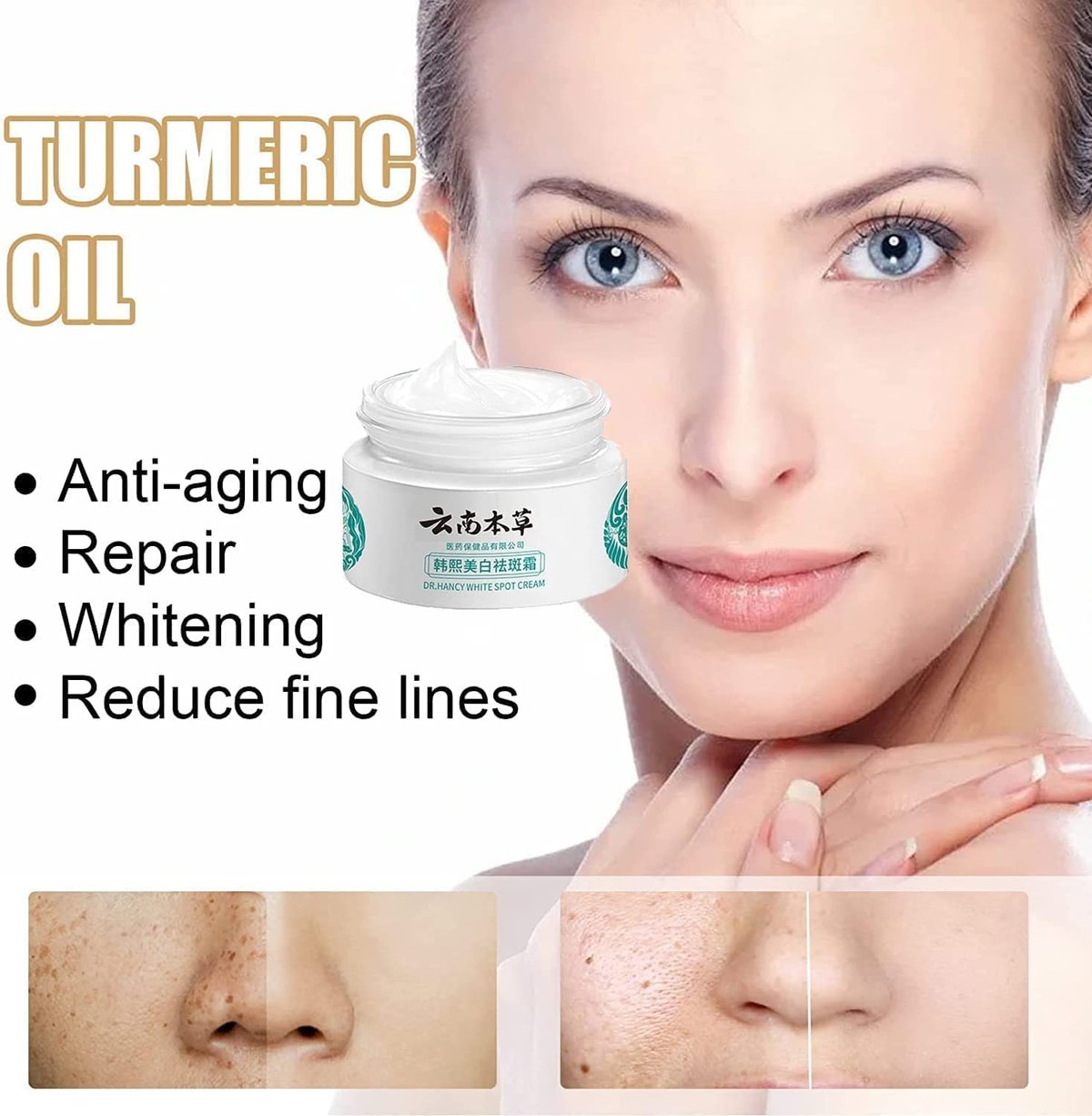 (Last Day Promotion 49% OFF) - Yunnan Herbal Whitening and Freckle-Removing Cream: Fades Spots and Brightens Skin Tone