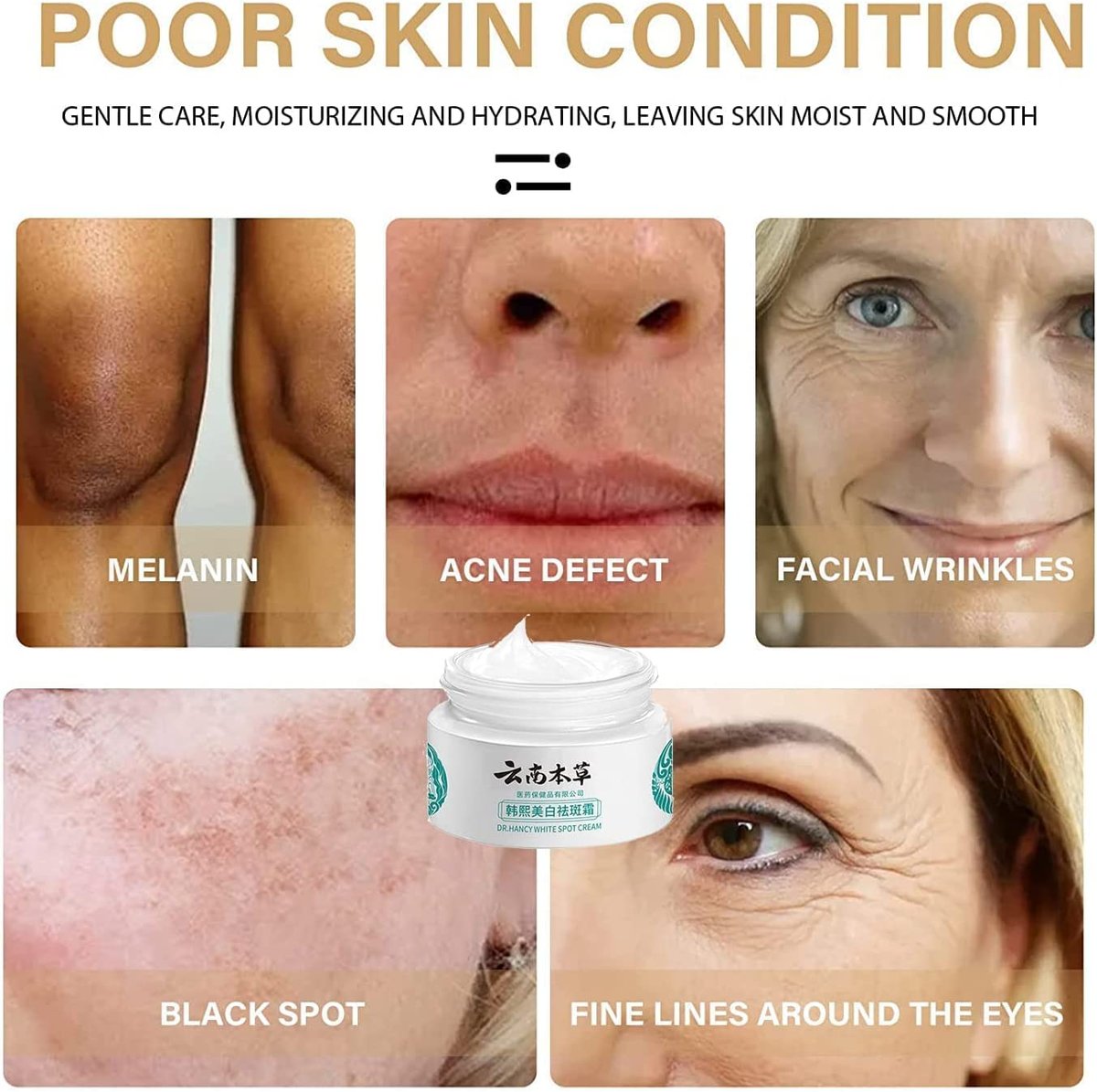 (Last Day Promotion 49% OFF) - Yunnan Herbal Whitening and Freckle-Removing Cream: Fades Spots and Brightens Skin Tone