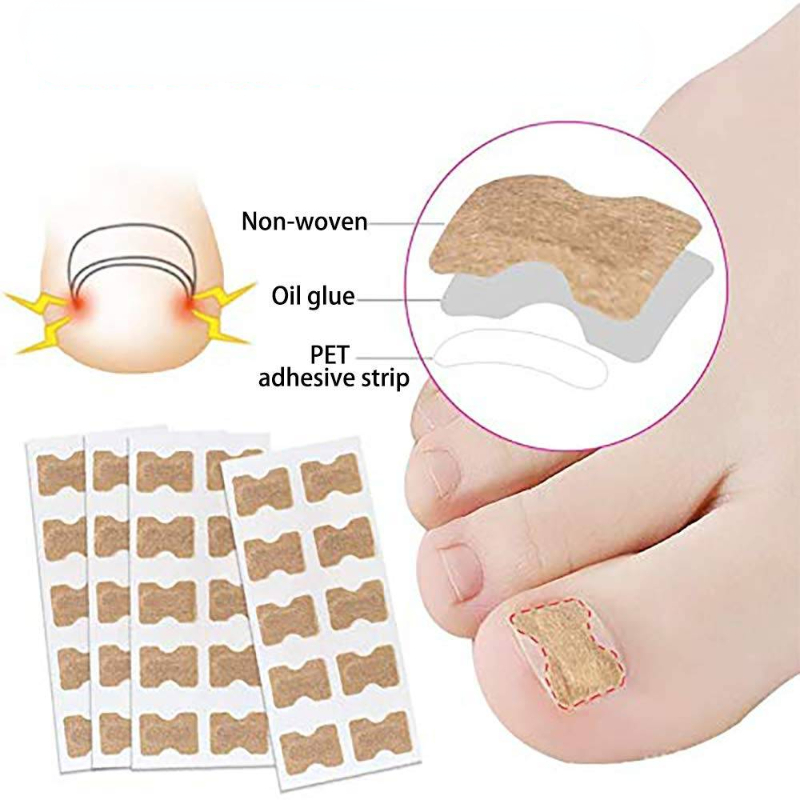 Nail Correction Patches 