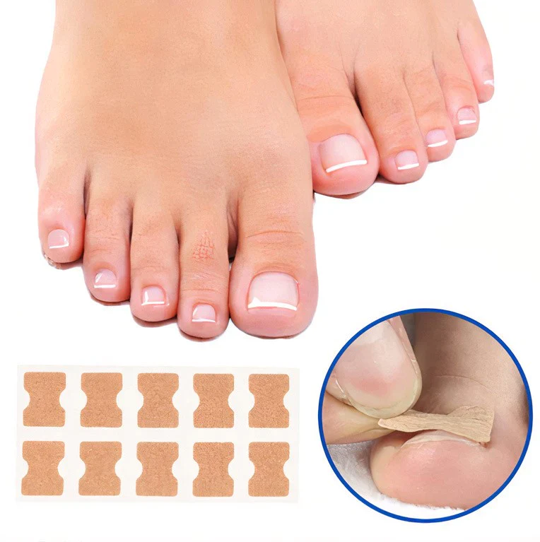 Nail Correction Patches 