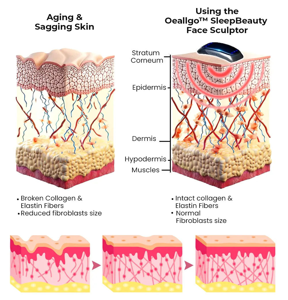 Oveallgo SleepBeauty ULTRA Face Sculptor