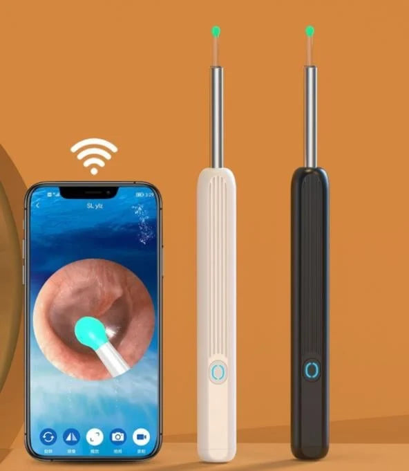 ProScope Smart Ear Cleaner