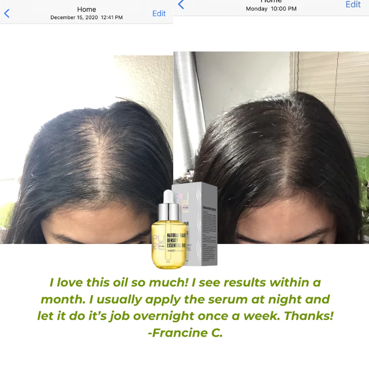 PURC Hair Growth Essential Oil - Reclaim Your Luscious Locks