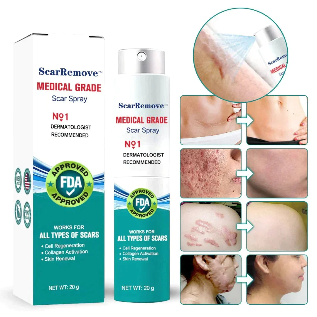 ScarRemove Advanced Scar Spray For All Types of Scars - For example Acne Scars. Surgical Scars and Stretch Marks