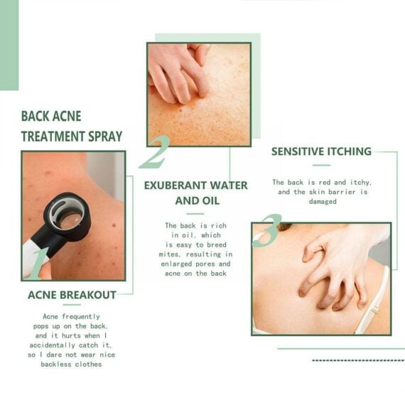 Back Acne Treatment Spray
