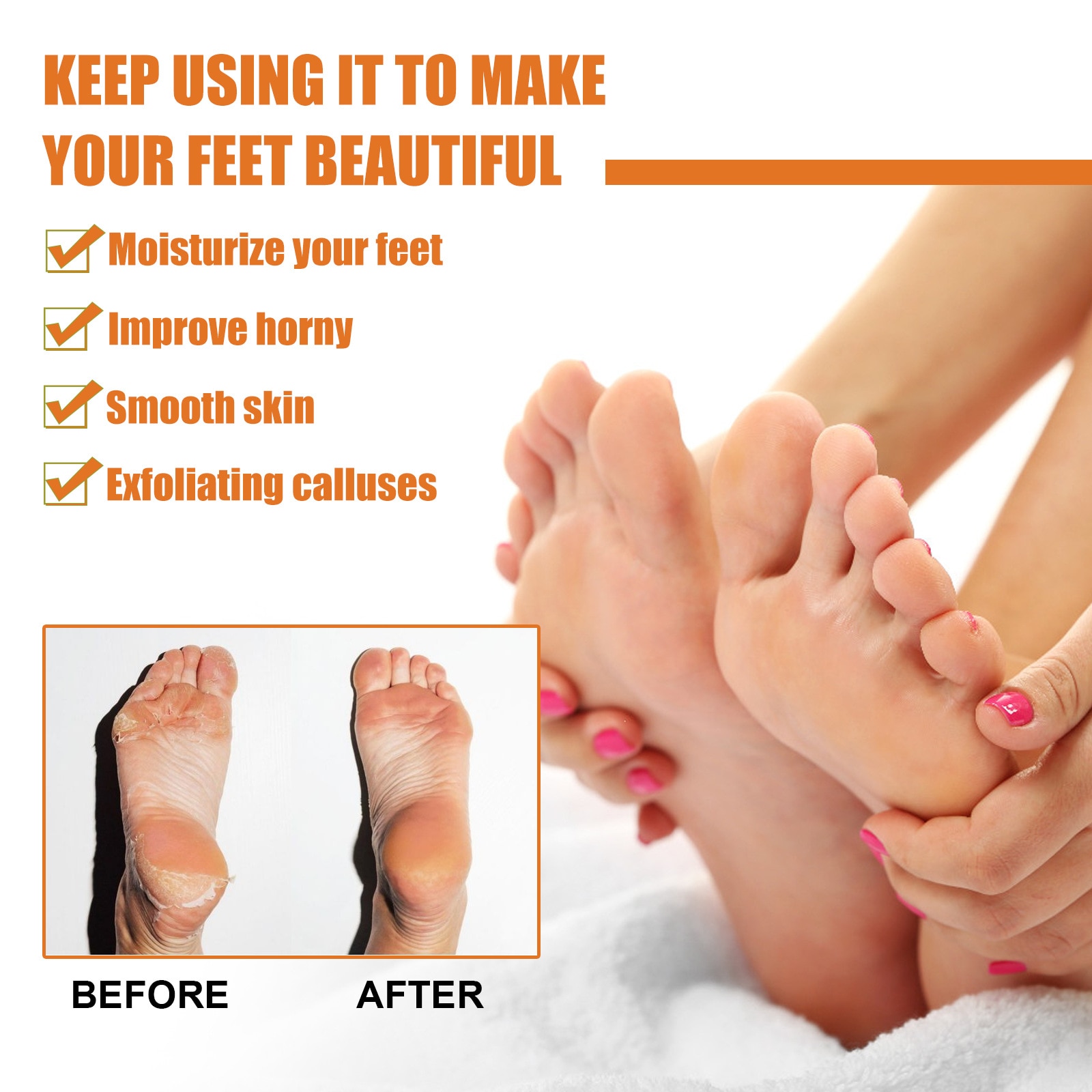 GFOUK Foot Callus Removal Spray