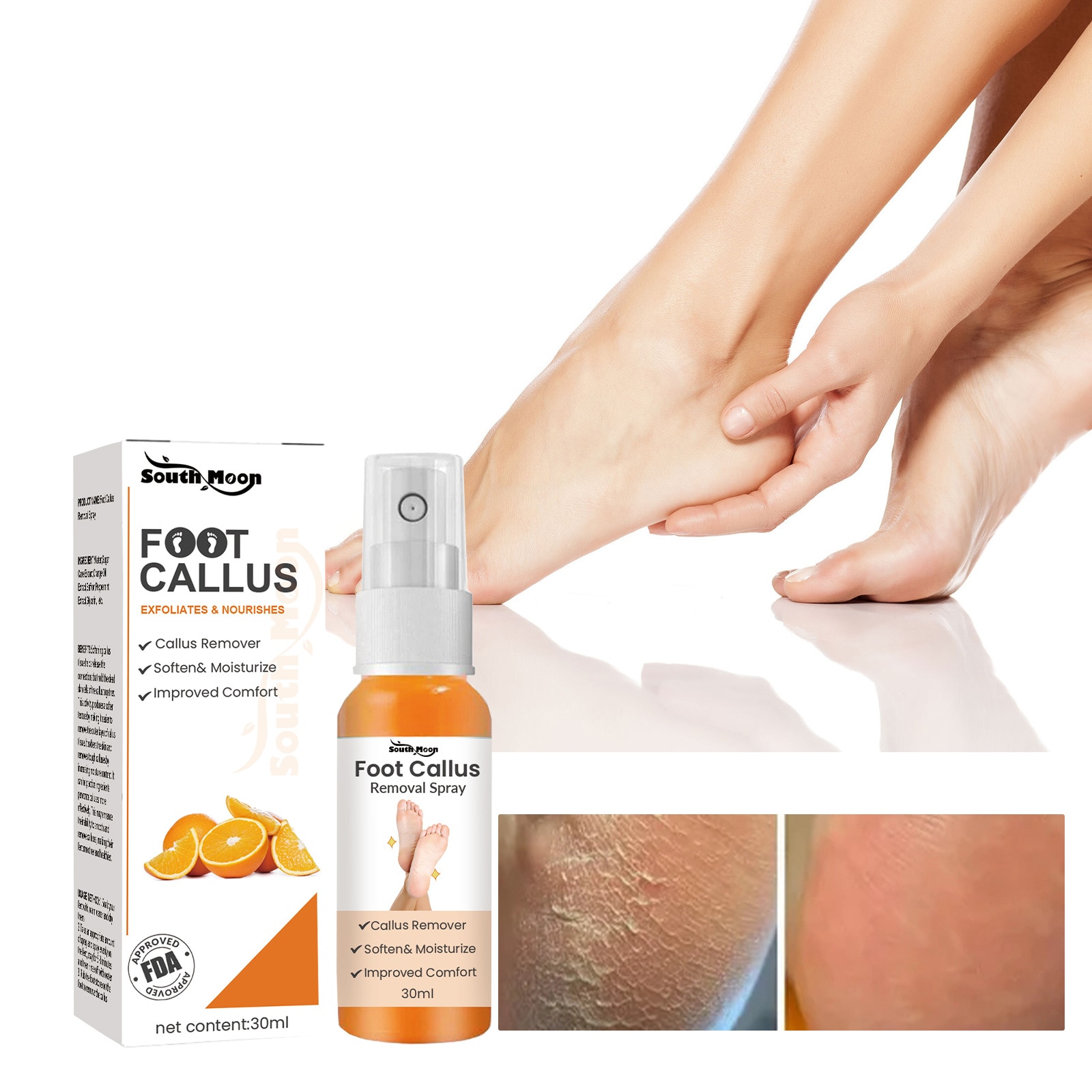 GFOUK Foot Callus Removal Spray