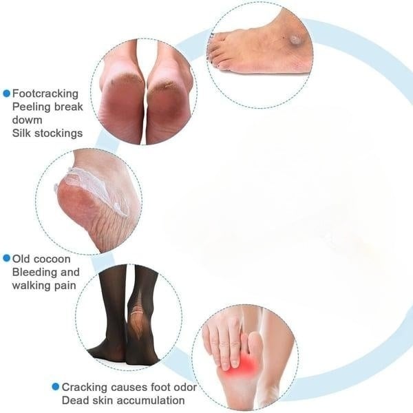 HOT SALE - New Electric Foot Grinder Skin Hard Rupture Skin Trimmer Dead Skin