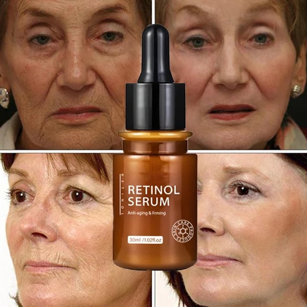 HOT SALE 49% OFF--New Retinol Anti Aging Face Serum