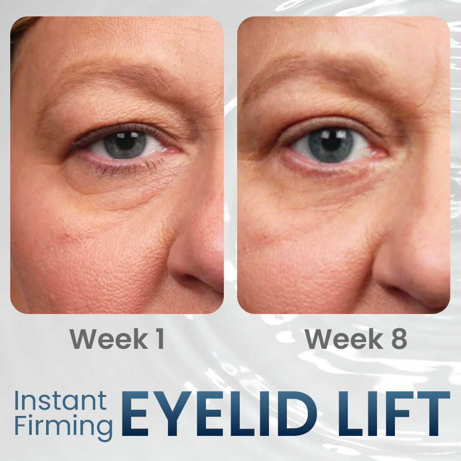 HOT SALE 70% OFF - Firm Peptide Firming Eye Gel