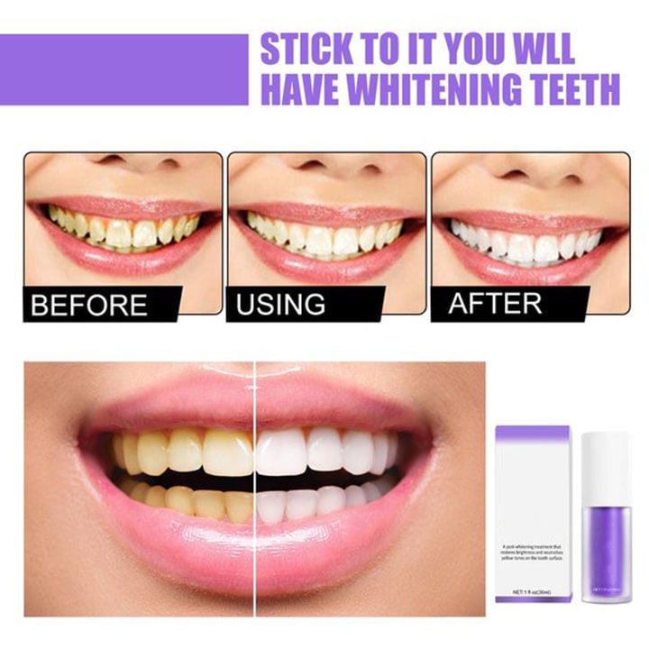 LAST DAY 48% OFF - 2.5 Teeth Colour Corrector Serum