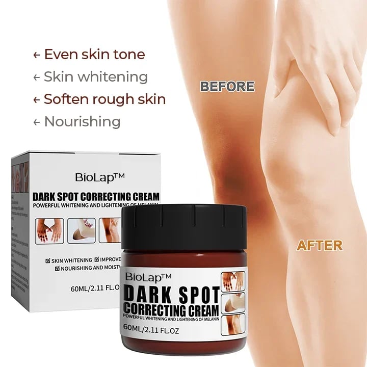 Last Day Promotion 70% OFF - BioLap Dark Spot Correcting Cream