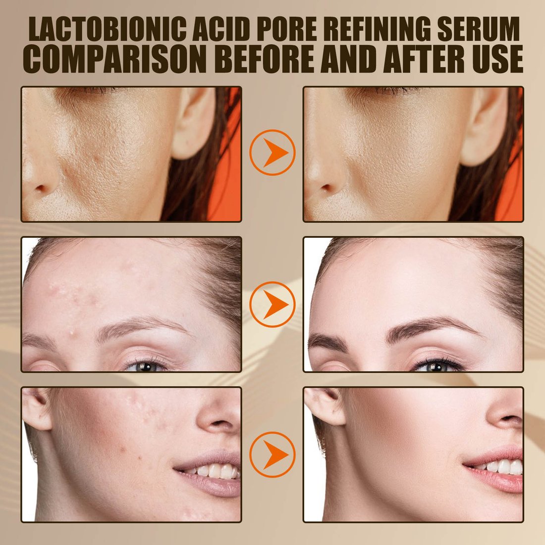 Last Day Promotion 70% OFF - Lactobionic acid pore contraction Face Serum