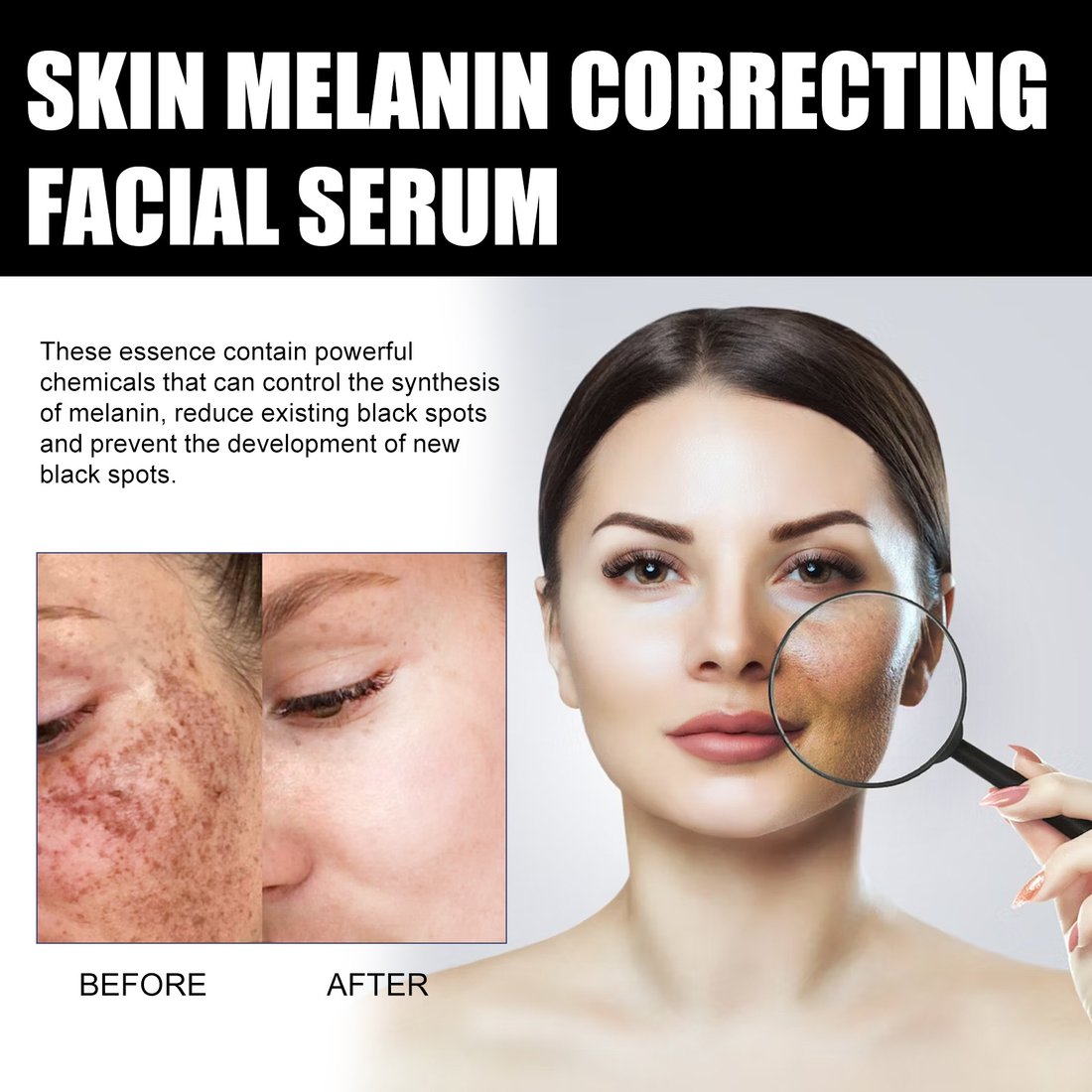 Last Day Promotion 70% OFF - Melanin Correcting Facial Serum