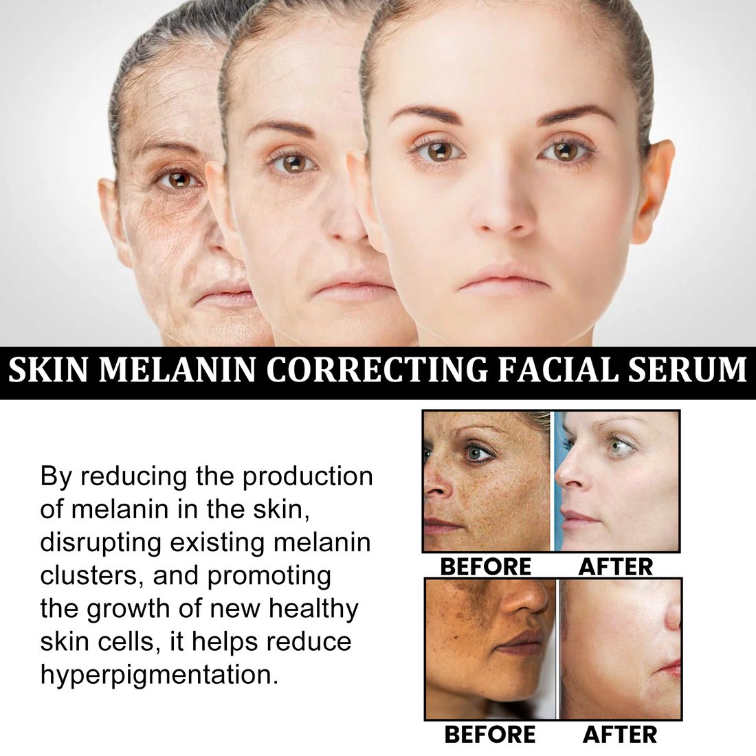 Last Day Promotion 70% OFF - Melanin Correcting Facial Serum