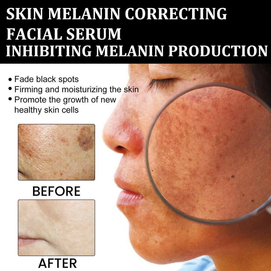 Last Day Promotion 70% OFF - Melanin Correcting Facial Serum