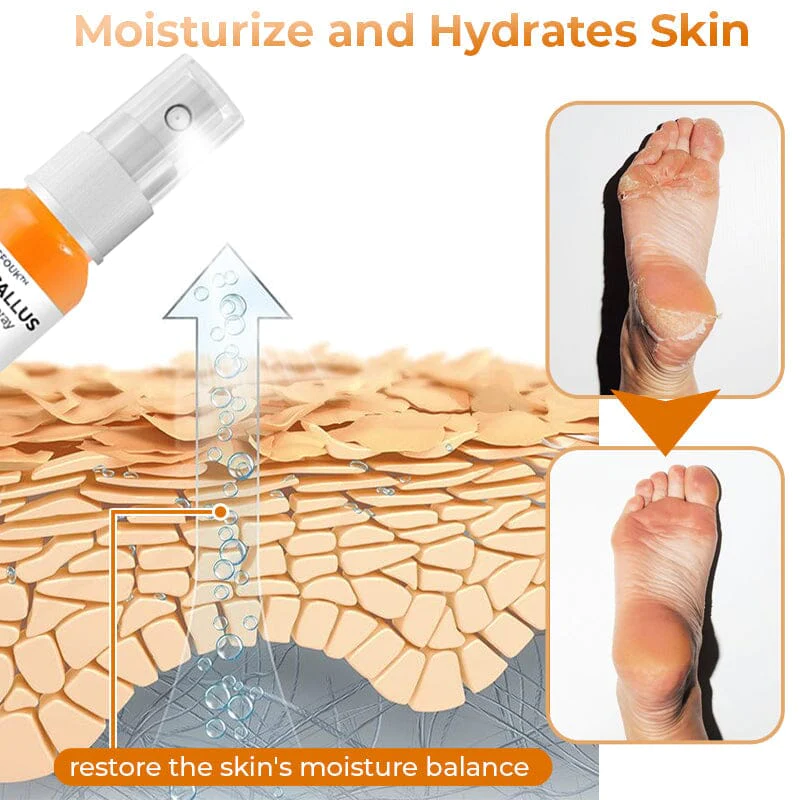 (Limited Time Discount - Last Day 70% Off) GFOUK Foot Callus Removal Spray