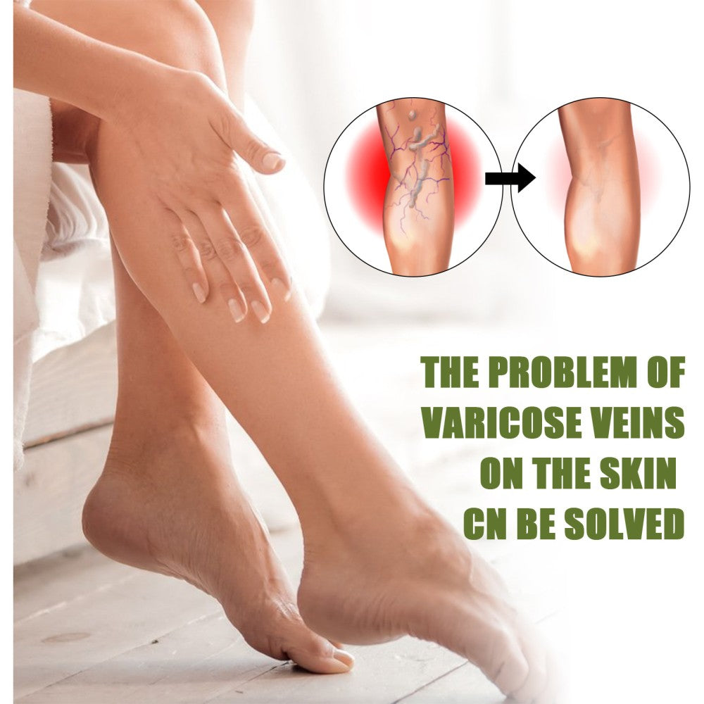 MEDix Varicose Veins Spray