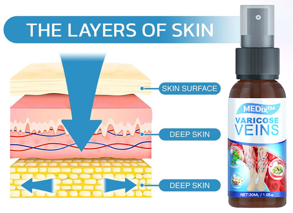 MEDix Varicose Veins Spray