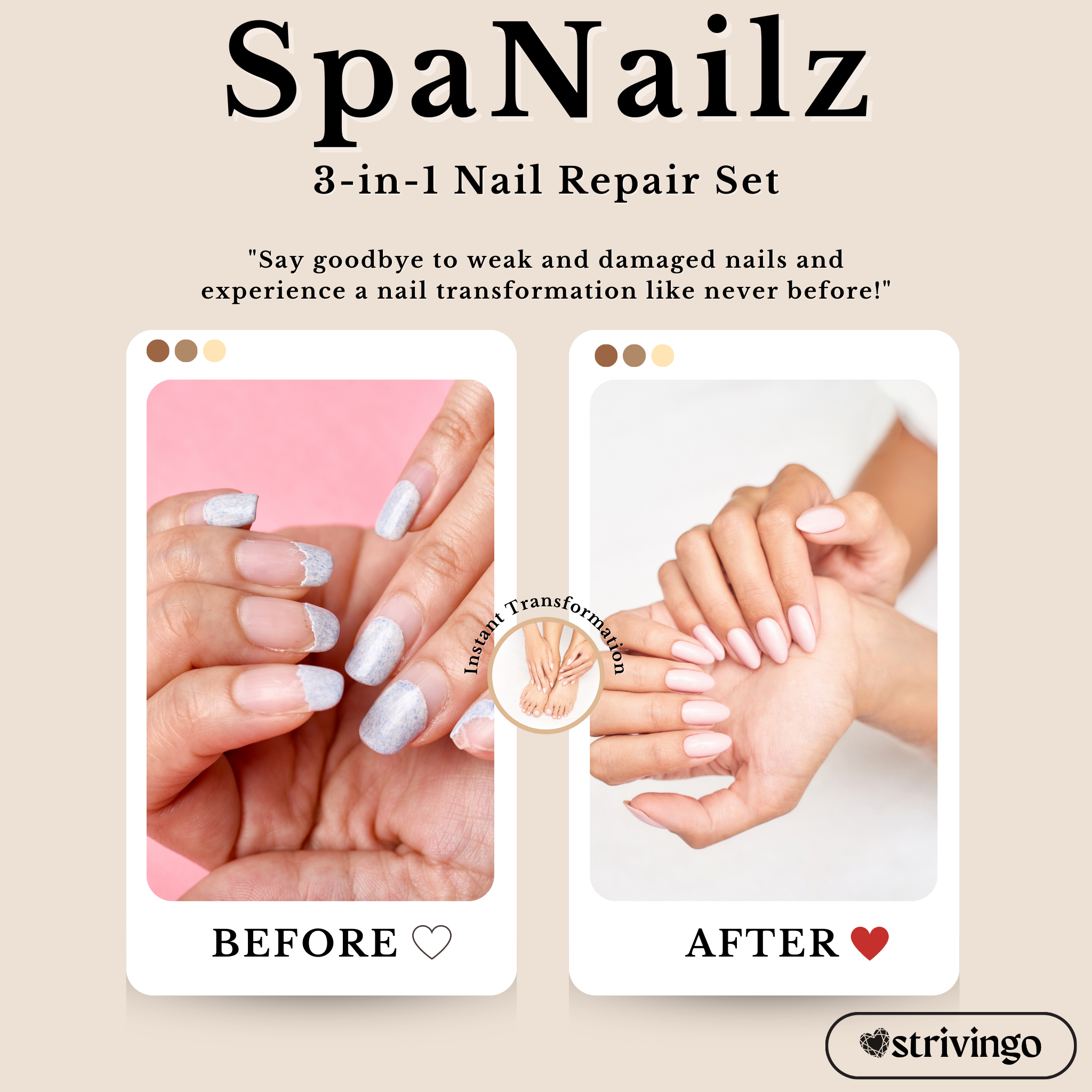 SpaNailz  3 in 1 Nail Repair Set | incl. Brush & UV Lamp