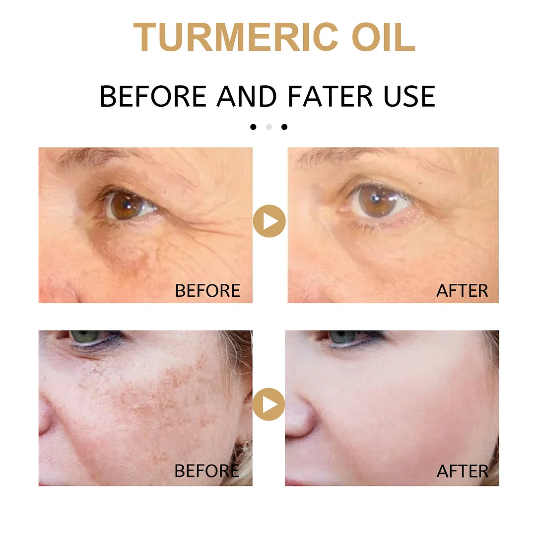 Turmeric Dark Spot Corrector Serum