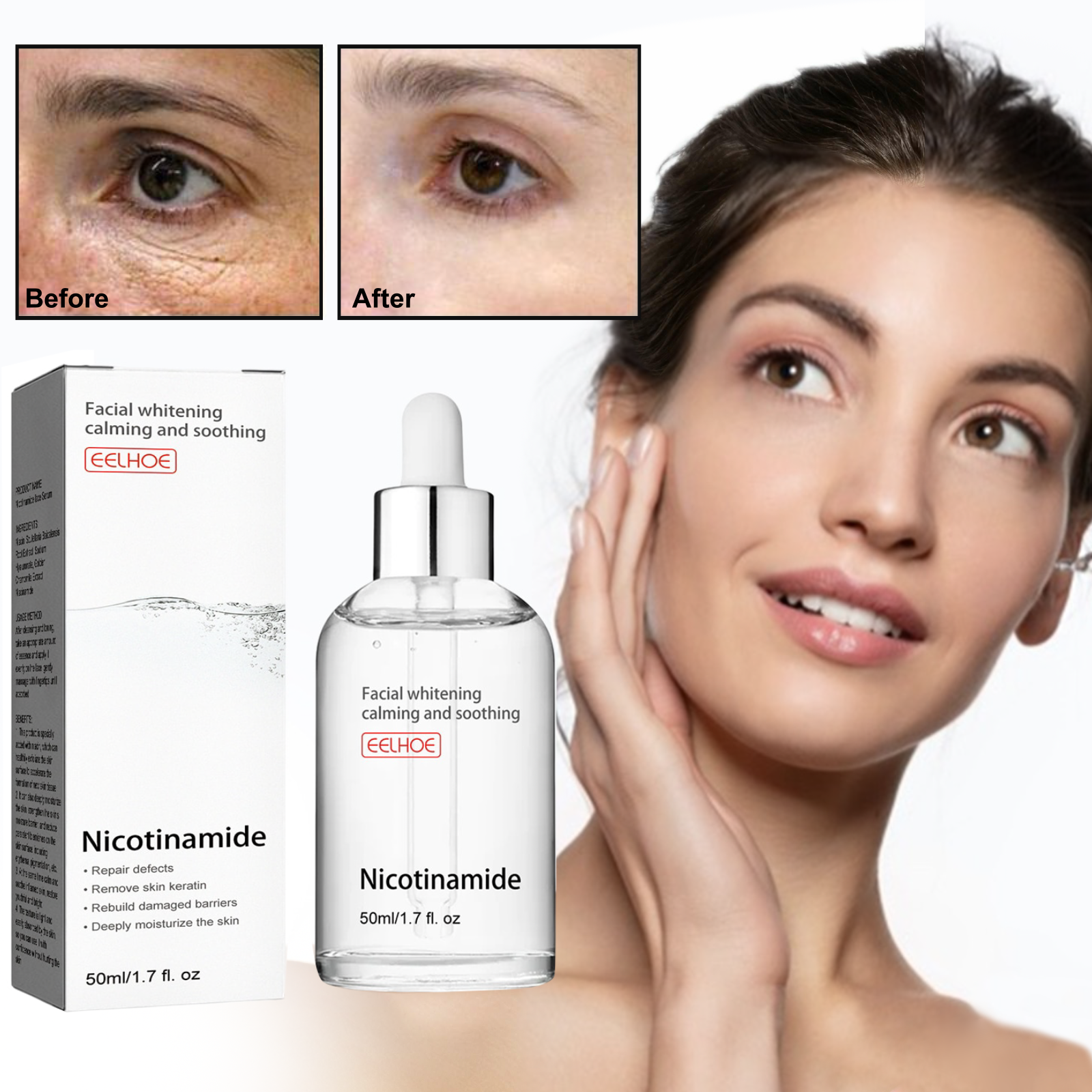 Buy 1 Get 1 Free - Niacinamide Spot Correcting Anti-Acne Serum