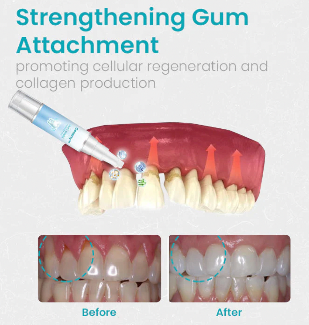 Ceoerty Gum Shield Therapy Gel