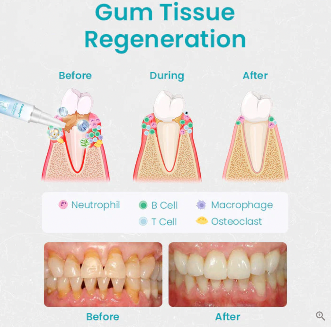 Ceoerty Gum Shield Therapy Gel