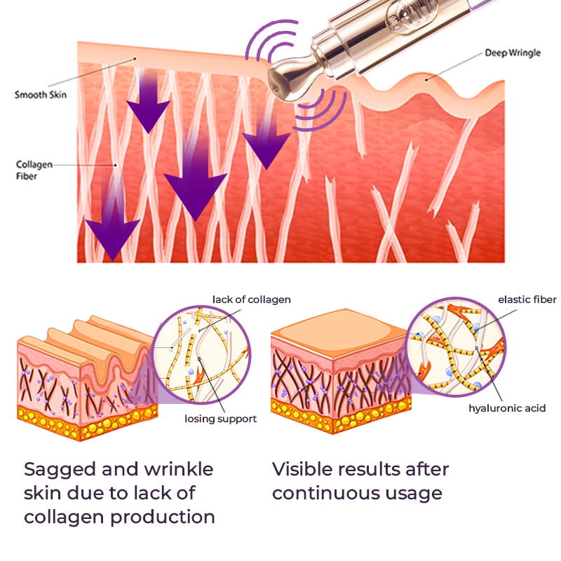 Milk Spots Therapy Electric Serum Pen