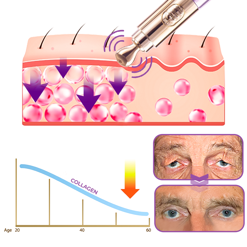 Milk Spots Therapy Electric Serum Pen