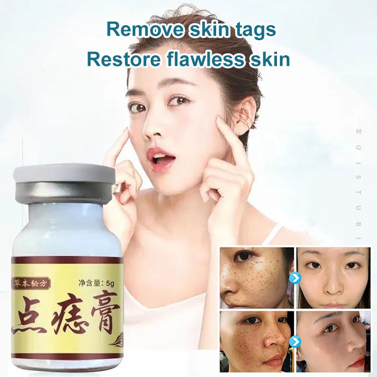 LAST DAY 70% OFF - Concentrated Potent Skin Tag Removal Cream