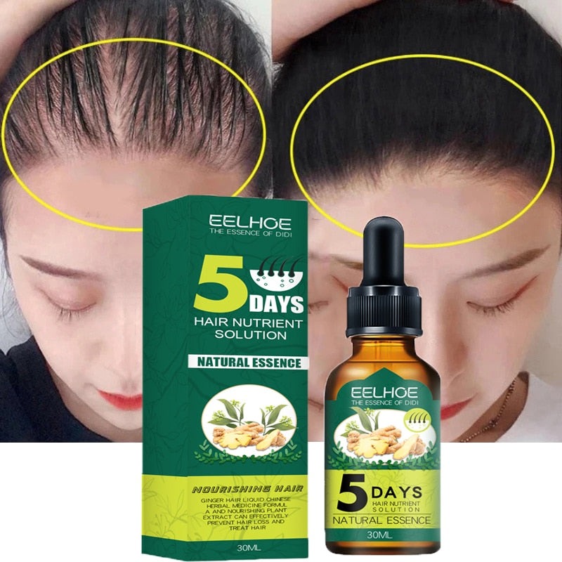 (LAST DAY SALE 50% OFF) ORIGINPRO Ginger Hair Regrowth Essence