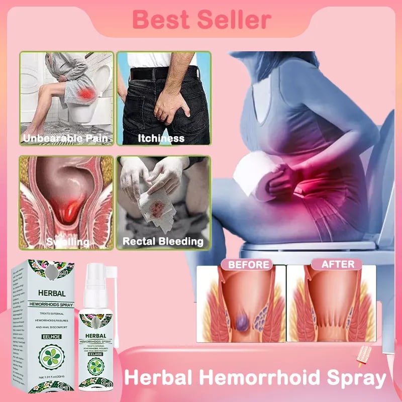 2023 Experts Recommend Product-Herbal Hemorrhoids Spray