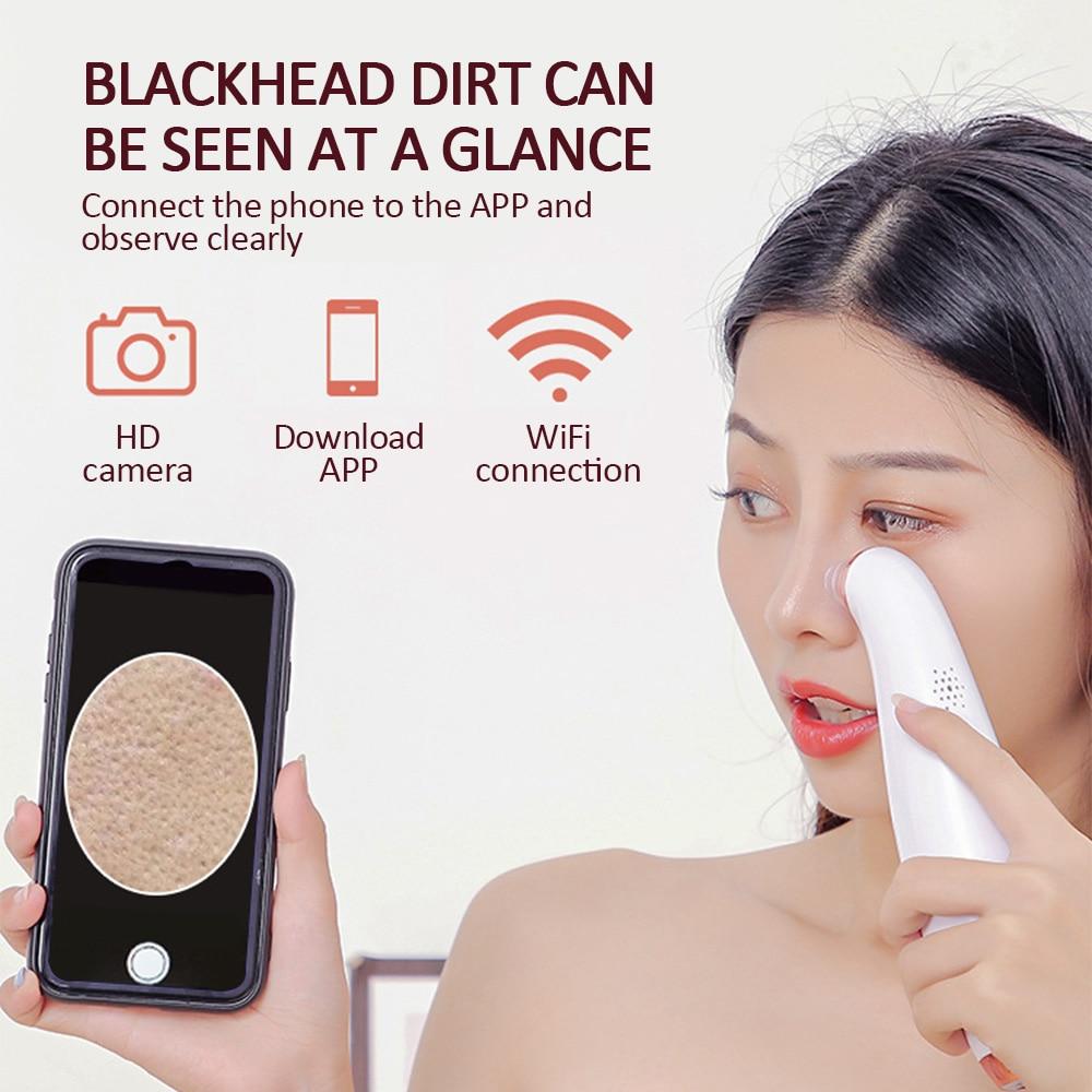 BlackVac Visual Blackhead Remover Pro