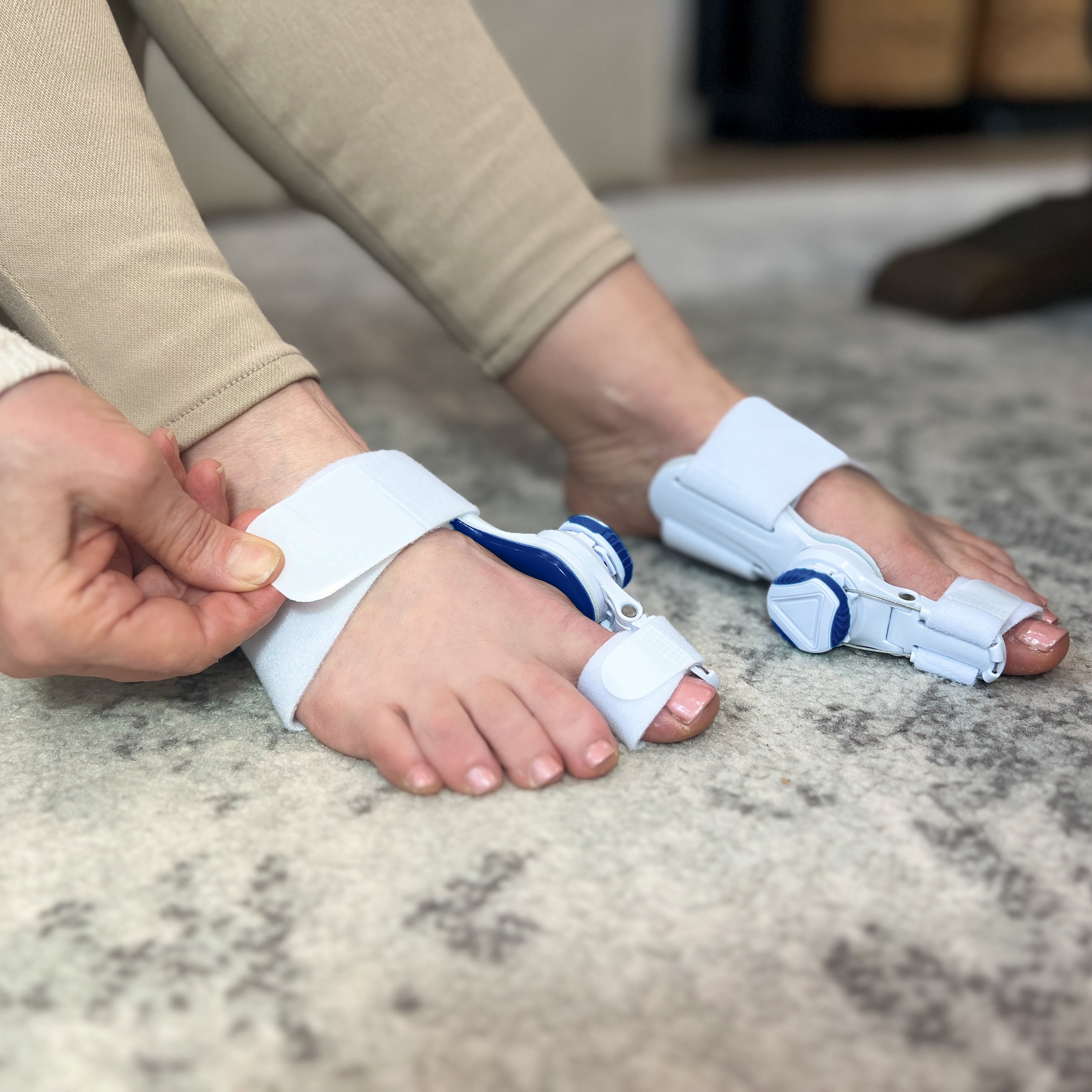 Bunion Fixed Splint