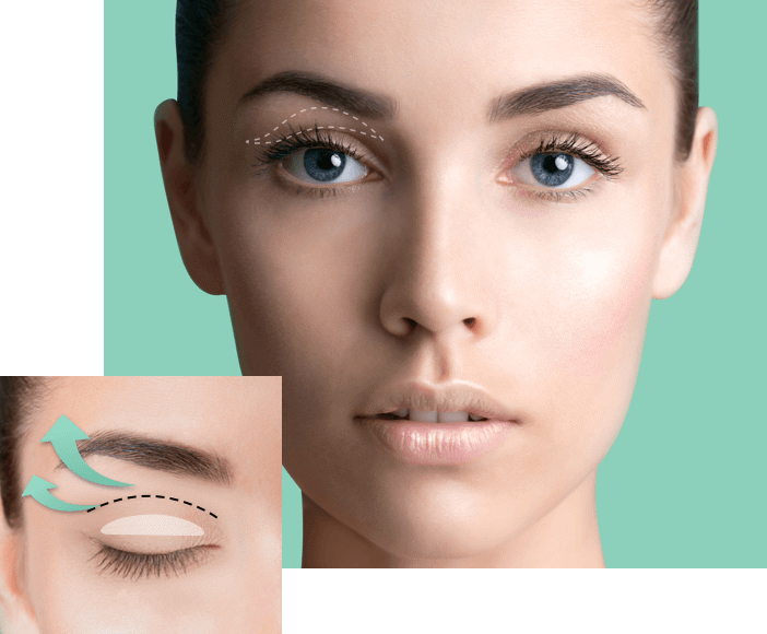 Clear Stock Last Day 49% OFF - Satvee Waterproof Double Eyelid Tapes