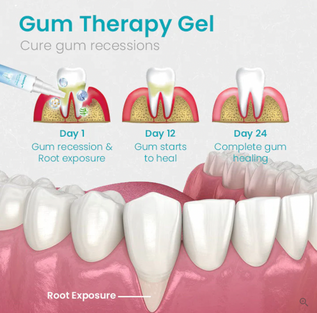 (LAST DAY SALE-80% OFF) DentiZen Gum Therapy Gel