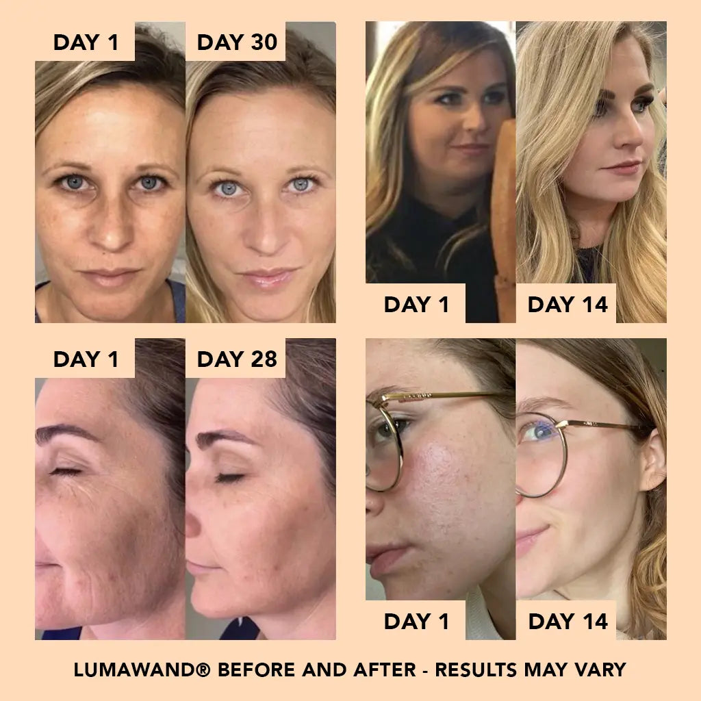 LumaWand 4-in-1 Skincare Wand