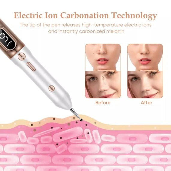 Neuderma Fibroblast Plasma Pen Lulunami