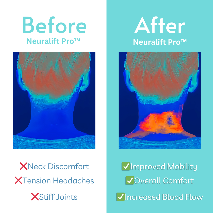 Neuralift PRO