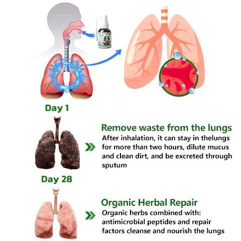 RespiNature Herbal Lung Cleanse Mist - Powerful Lung Support, Cleanse & Breathe - Herbal Mist