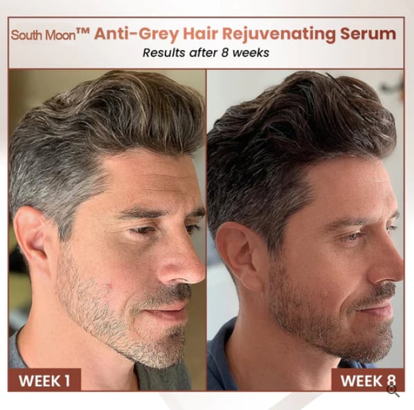 South Moon Anti-Greying Hair Serum (Buy 1 Get 1 Free)