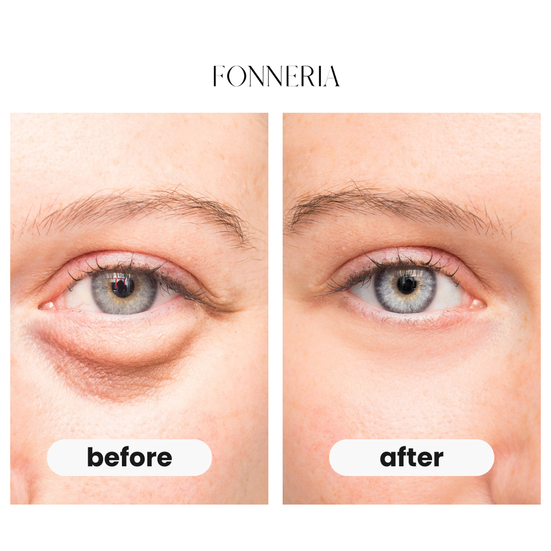 Fonneria unwind - eye beauty pro