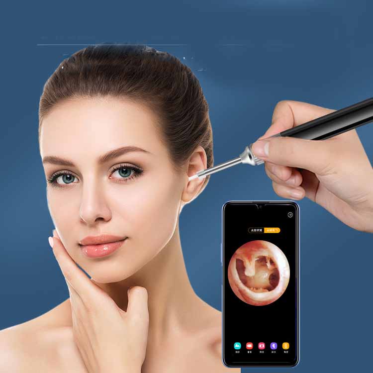 WiFi Ear Cleaning Endoscope – Smartbud Ear Cleaner