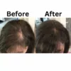Brilixco - Hair Growth Oil